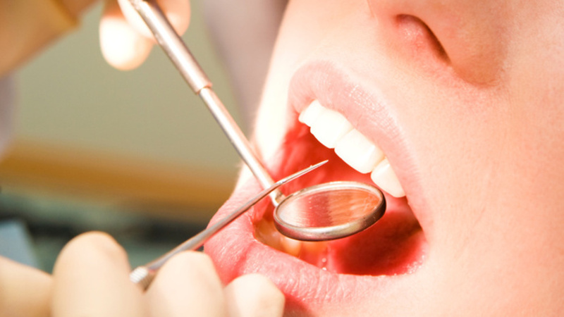 4 Reasons Why You Should Consider Dental Bridges in Scottsdale, AZ