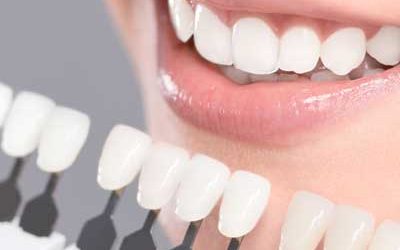 Achieve Straight Teeth Effortlessly and Confidently with Invisalign in Westlake